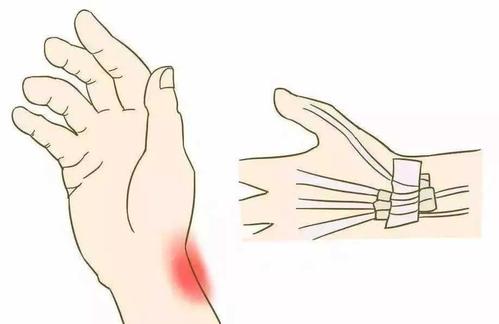 如何辩证治疗牛皮癣