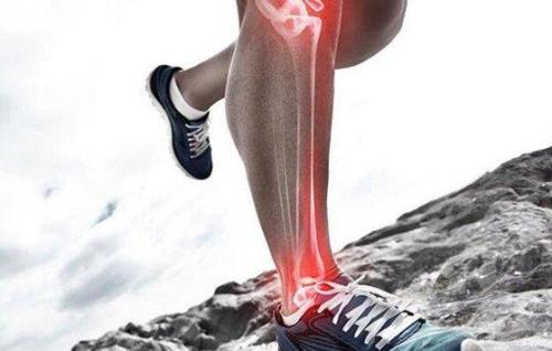 怎么才能治疗牛皮癣