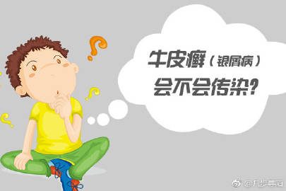 牛皮癣对人体造成的危害