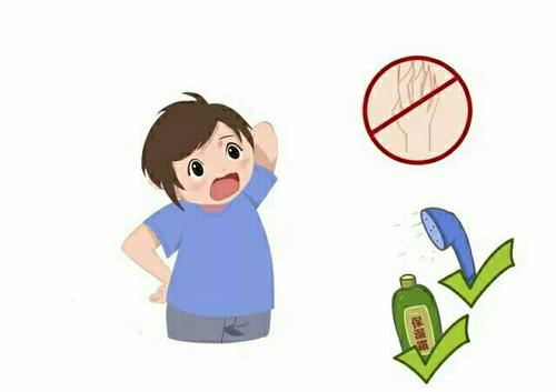 牛皮癣怎么治效果好