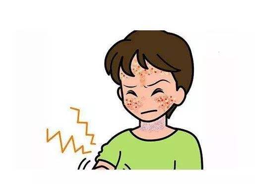 银屑病一定扩展吗