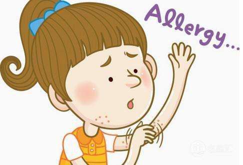 什么是脂溢性银屑病