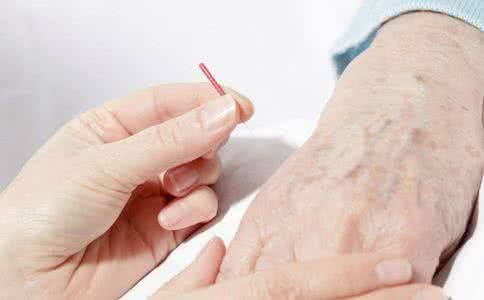 广州哪家医院治疗牛皮癣