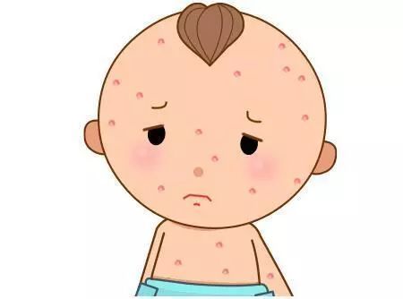 长水泡就是水痘吗