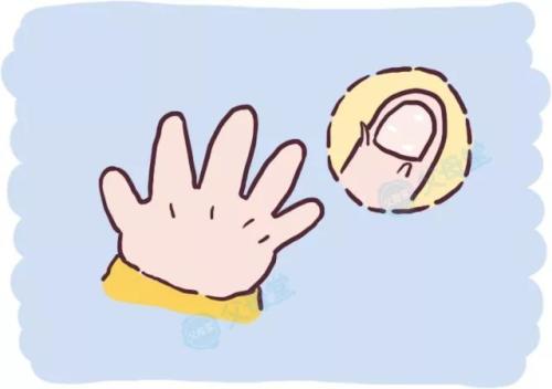 谈牛皮癣科学护理法则 谈牛皮癣科学护理法则