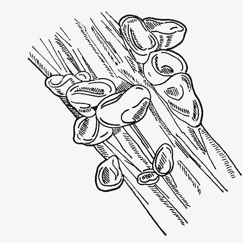 凉拌木耳怎么做