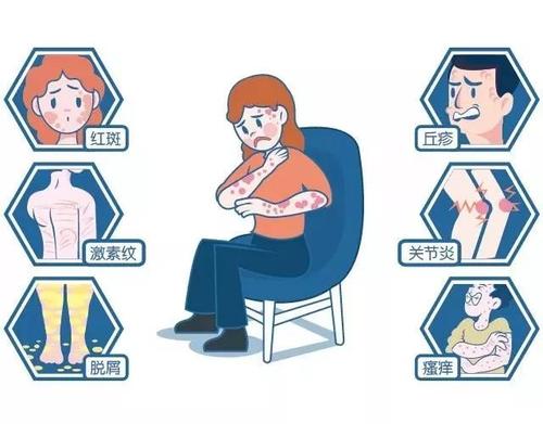 自己患有牛皮癣该咋办