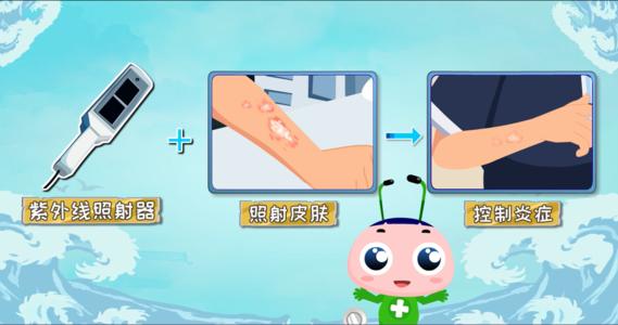 牛皮癣用药误区