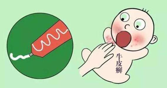 银屑病用药技巧